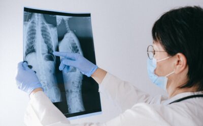 What are marijuana’s effects on lung health?